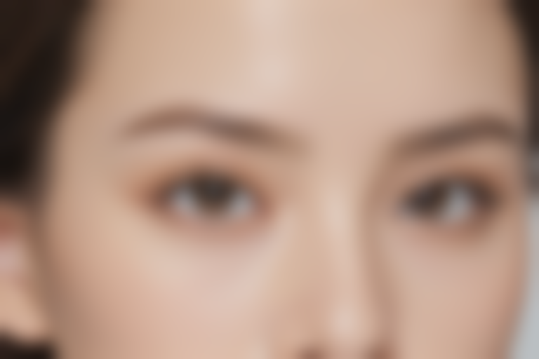 临沂光明眼科医院近视手术的经济成本:双焦点人工晶体价格16973元起