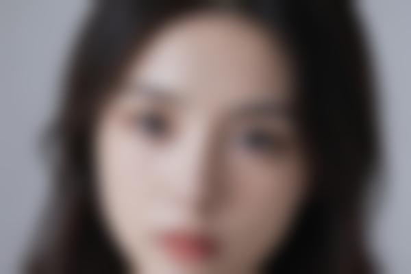 面部植发能解决哪些问题？真实与注意事项详解