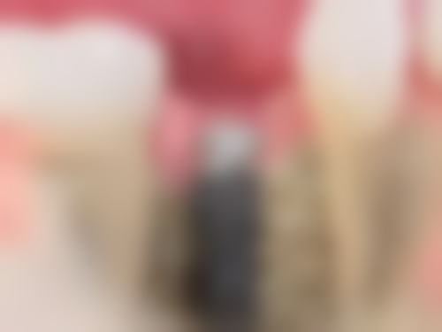 【拔牙检查】拔智齿/残根/松动牙/残缺牙/阻生智齿项目详解