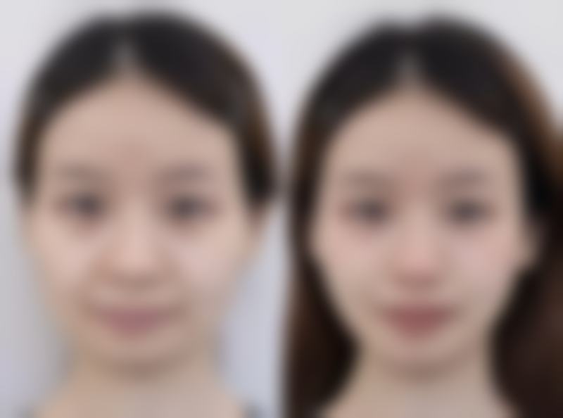 杭州广仁整形医院