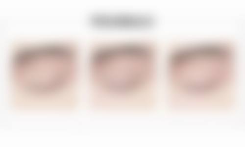 厦门思明蓓蕾斯特整形怎么样来院路线