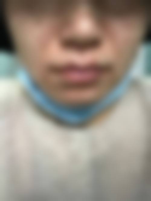 济南韩美整形医院怎么样特色项目及技术优势