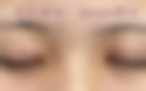 厦门思明蓓蕾斯特整形怎么样特色项目及技术优势