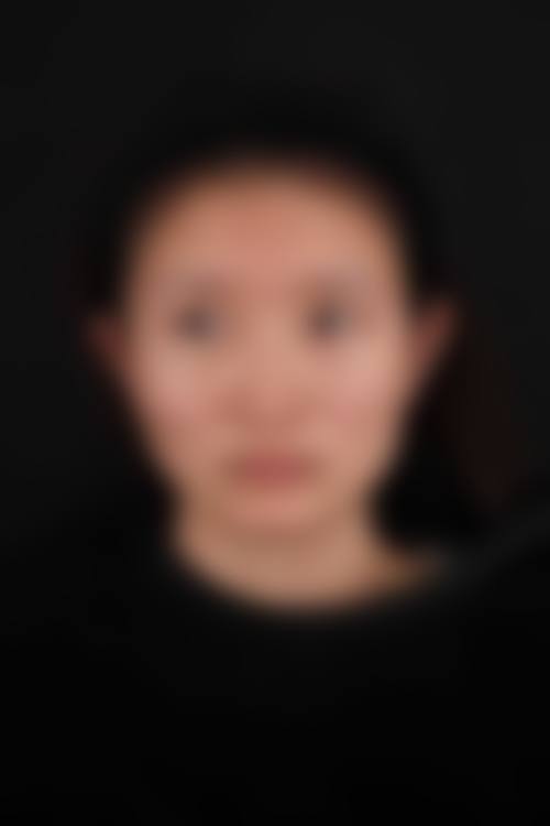 四川省人民医院友谊医院整形外科怎么样求美者反馈