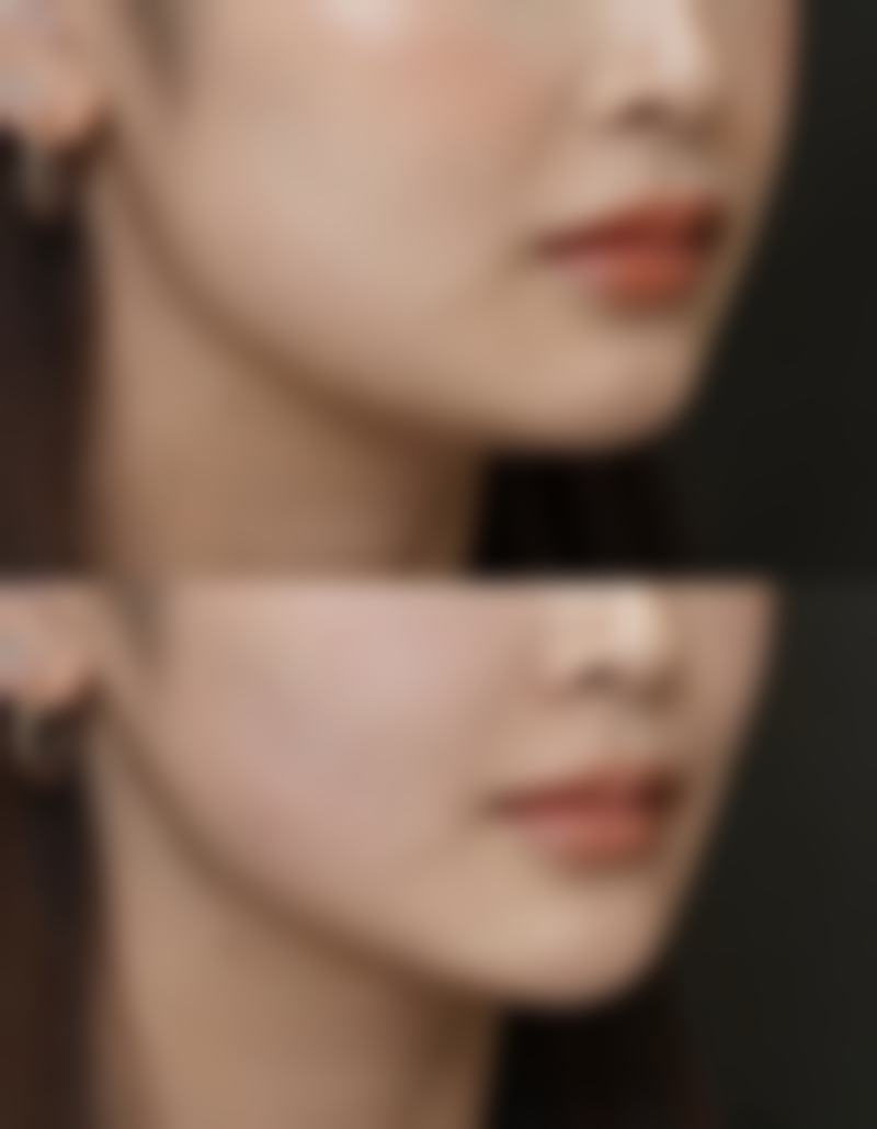 四川省人民医院友谊医院整形外科怎么样价格收费