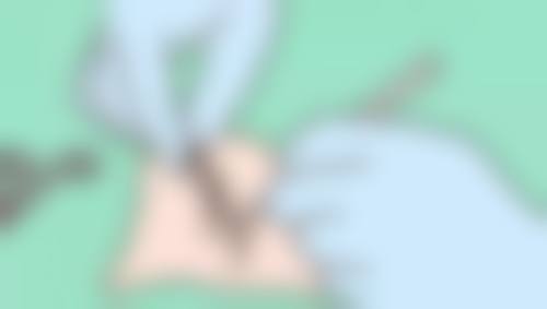 蒯权医生的医美理念与追求