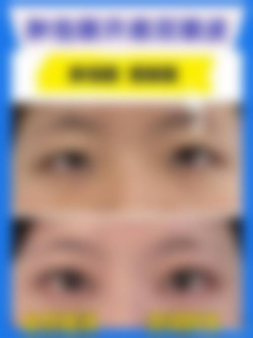 刘晓燕医生的成功实例