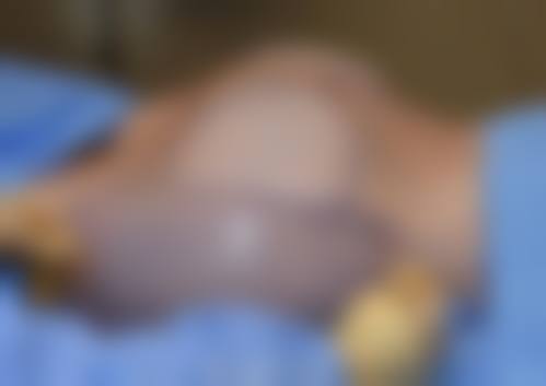 谢楠医生的成功实例