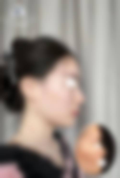 黄林胜医生：值得信赖的整形骨干医生