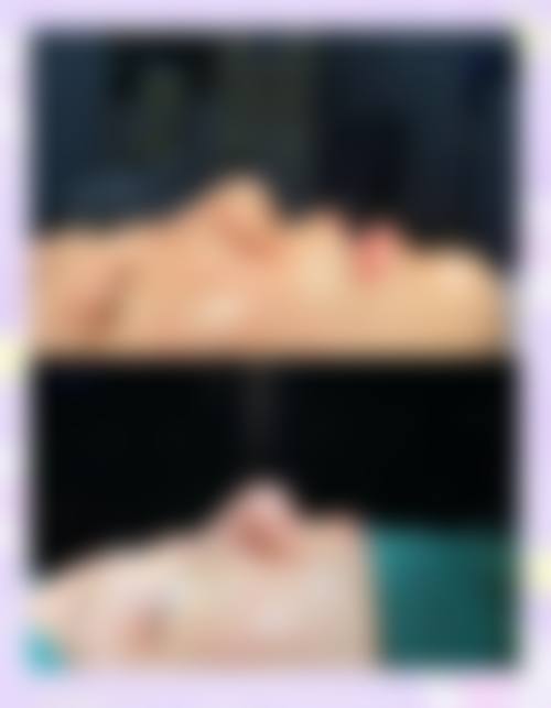 黄林胜医生的技术优势