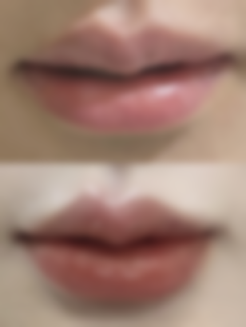 三河慈康医疗整形美容诊所怎么样价格收费