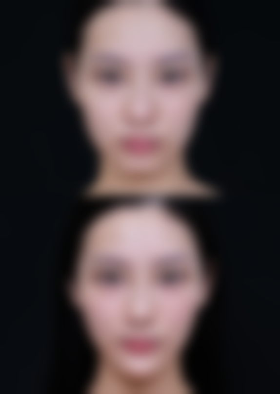 三河慈康医疗整形美容诊所怎么样来院路线