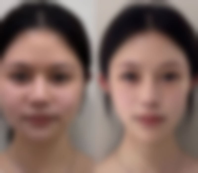 天津河北缇娜小针整形医院怎么样特色项目及技术优势