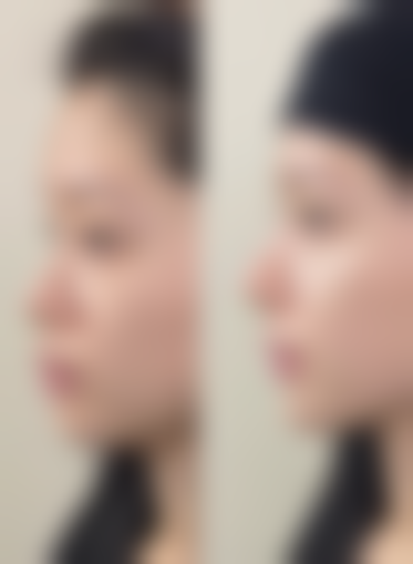 濮阳容美集星整形医院怎么样求美者反馈