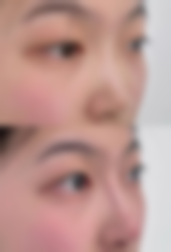 宁波艺星医疗美容医院（**JCI认证医院）怎么样求美者反馈