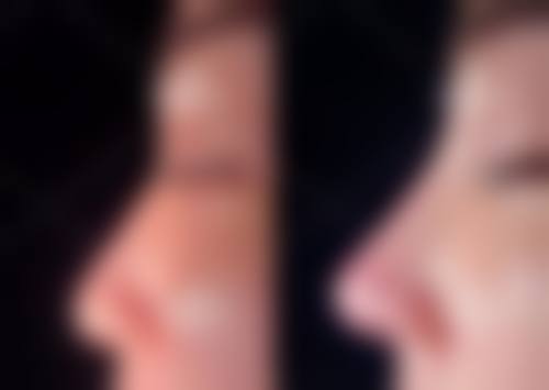 上饶市皮肤病性病防治所整形美容中 心怎么样求美者反馈