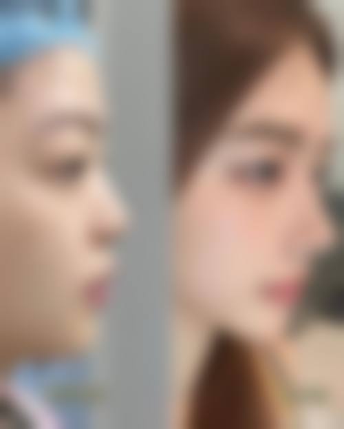 无锡洵美会医疗美容门诊部怎么样价格收费