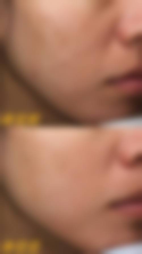 清华大学附属垂杨柳医院皮肤科怎么样价格收费