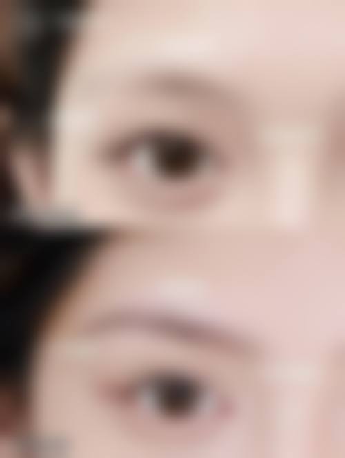 上海美之仁整形医院怎么样价格收费