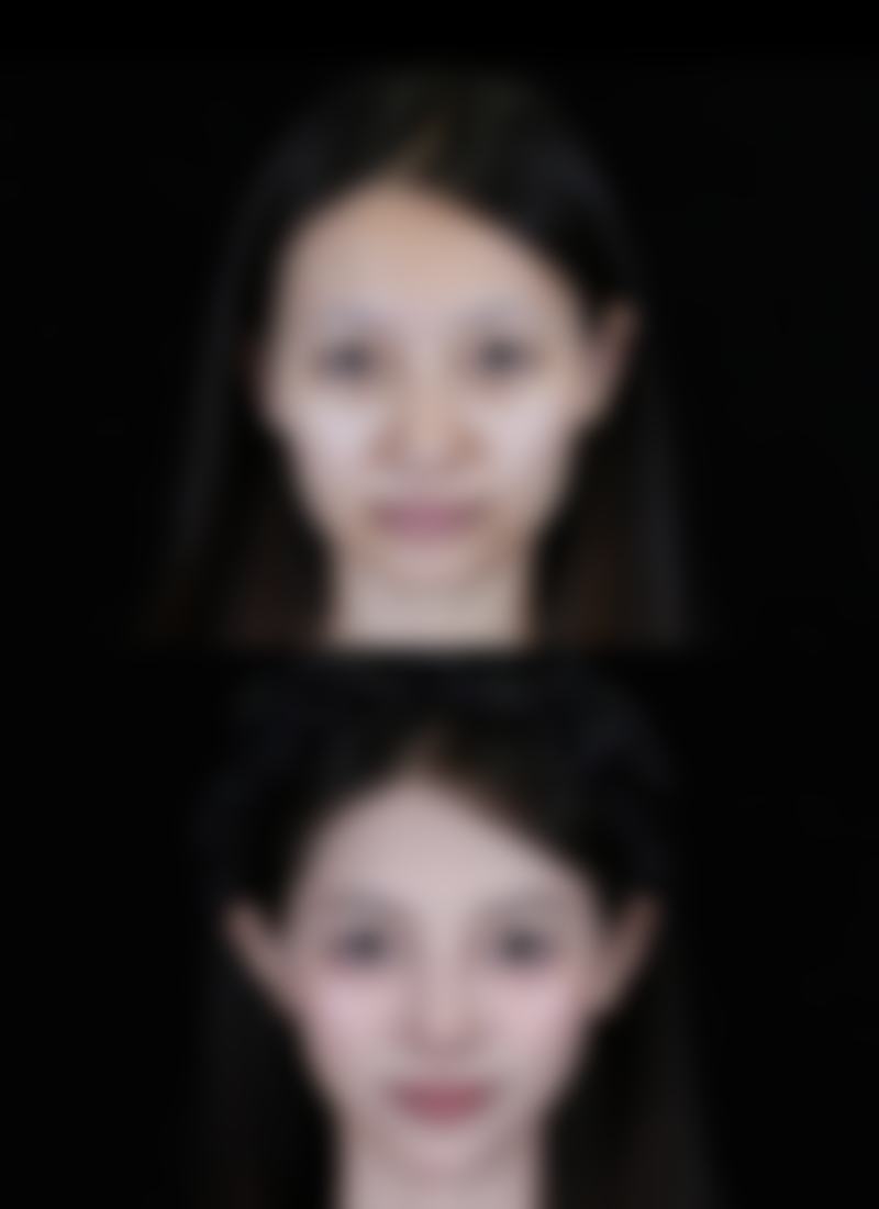 郑光锡的医美服务特色