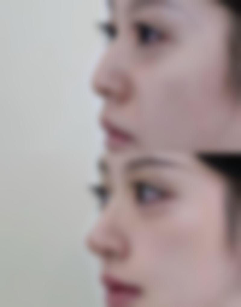 南宁梵容医疗美容诊所怎么样求美者反馈