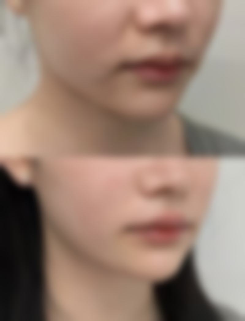 郑光锡助力的美丽蜕变实例