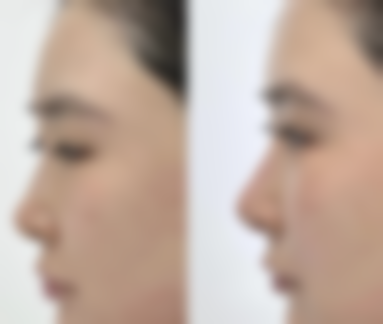 南宁梵容医疗美容诊所怎么样医生团队实力