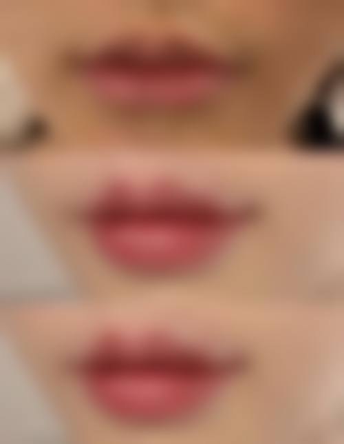 太原全美时代医疗美容诊所怎么样求美者反馈