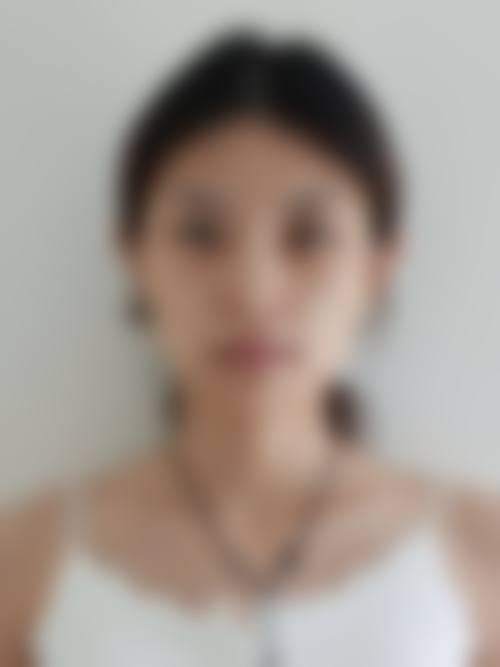 靖永军 医生的特色技术