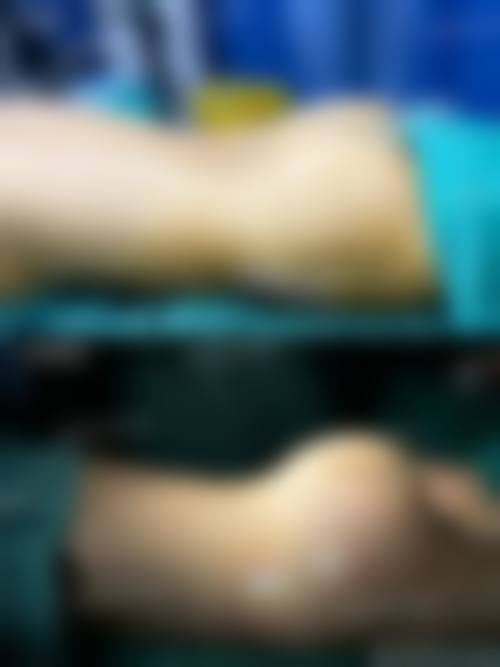 黄林胜医生的预约就诊