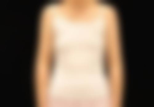 广州云云整形医院怎么样医生团队实力