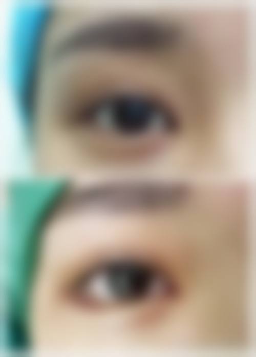 包头市倾城医疗美容怎么样来院路线