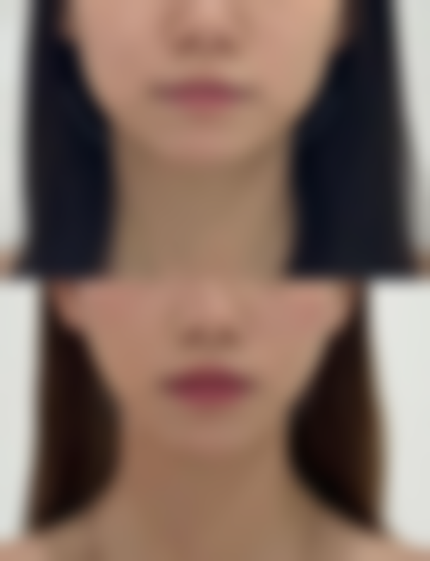 张诚洙医生的擅长领域