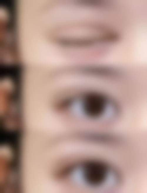 邱涛医生的激光美容手术优势