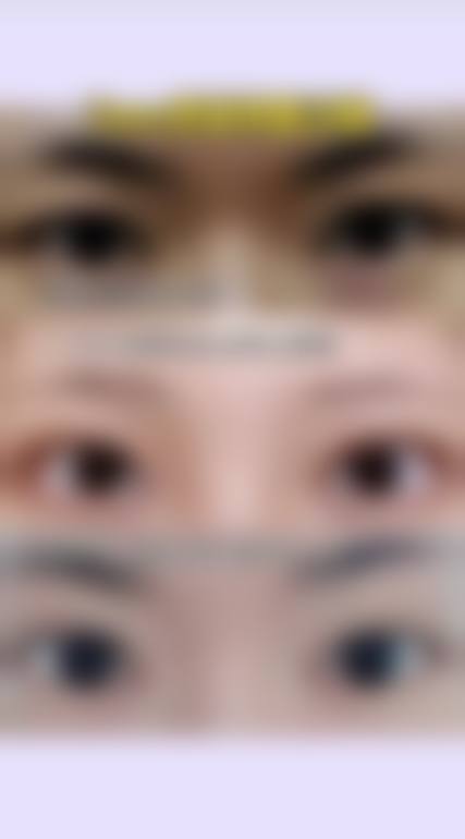 选择李芸医生的理由