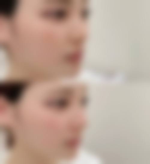 选择齐金杰医生：开启美丽新征程