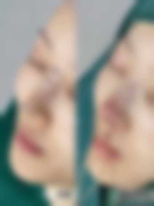 谢楠医生的技术优势体现