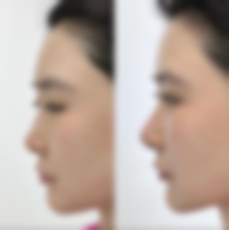 谭泳昌医生的患者信赖之选