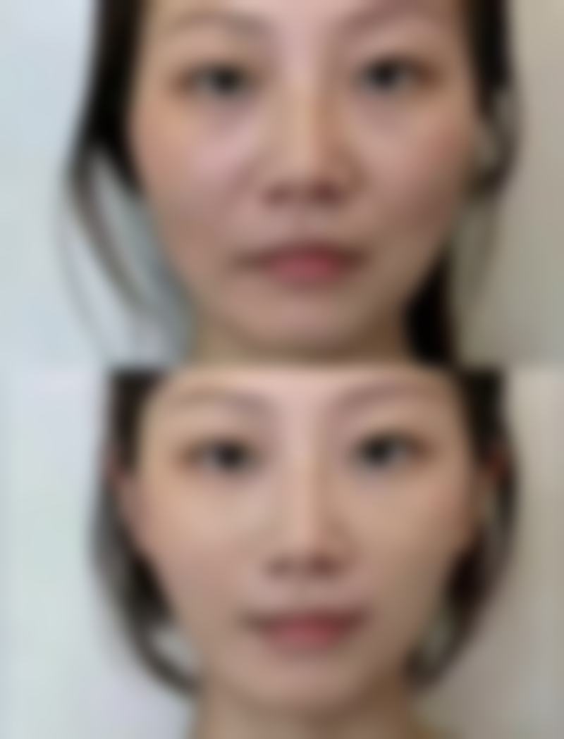 漳州正兴医院医疗美容中 心怎么样价格收费