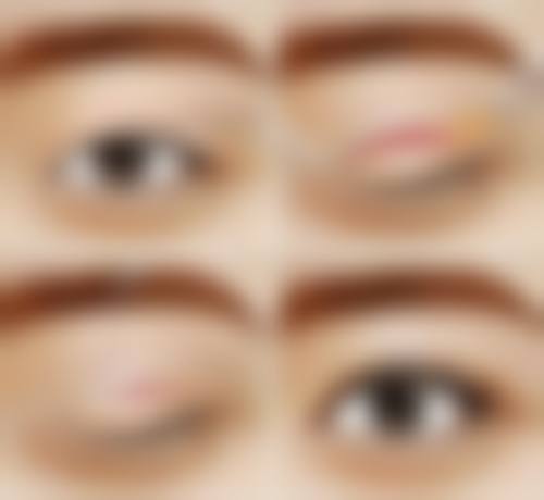 选择李芸医生的理由