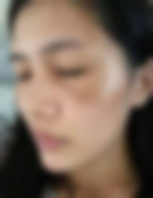 丽水田氏整形医院怎么样求美者反馈