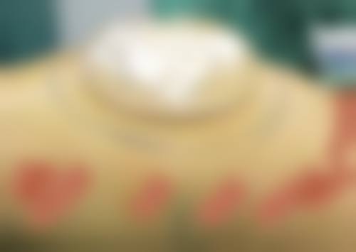 丁娓娓医生：助力医院打造优质整形服务