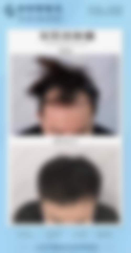 梁智辉医生助力自然与个性化整形