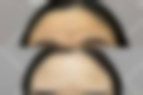 丁娓娓医生：个性化整形的践行者