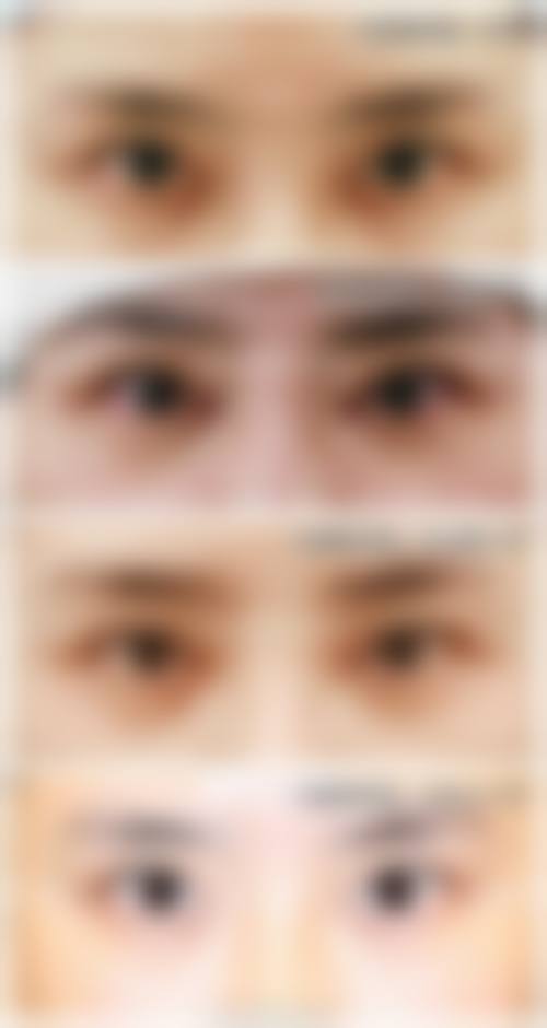 威海艾臻医疗美容诊所怎么样求美者反馈