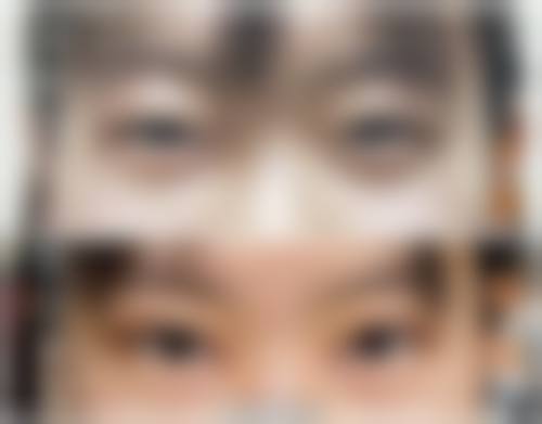 威海艾臻医疗美容诊所怎么样价格收费