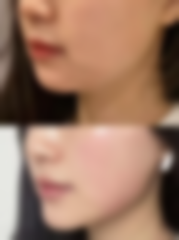 丽水田氏整形医院怎么样特色项目及技术优势