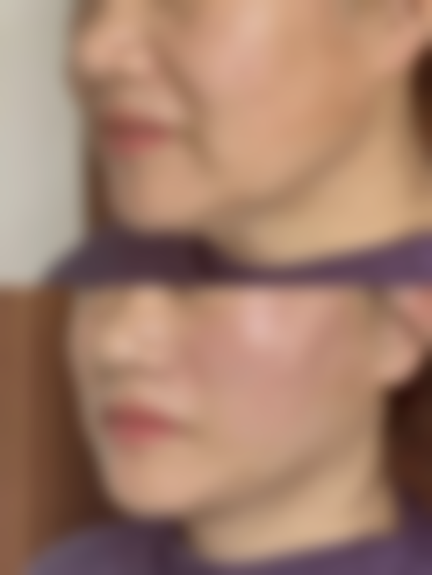 丽水田氏整形医院怎么样价格收费