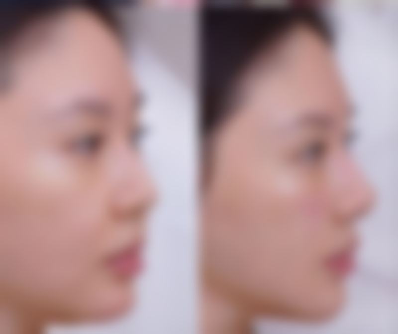 深圳驻颜静合整形医院怎么样来院路线