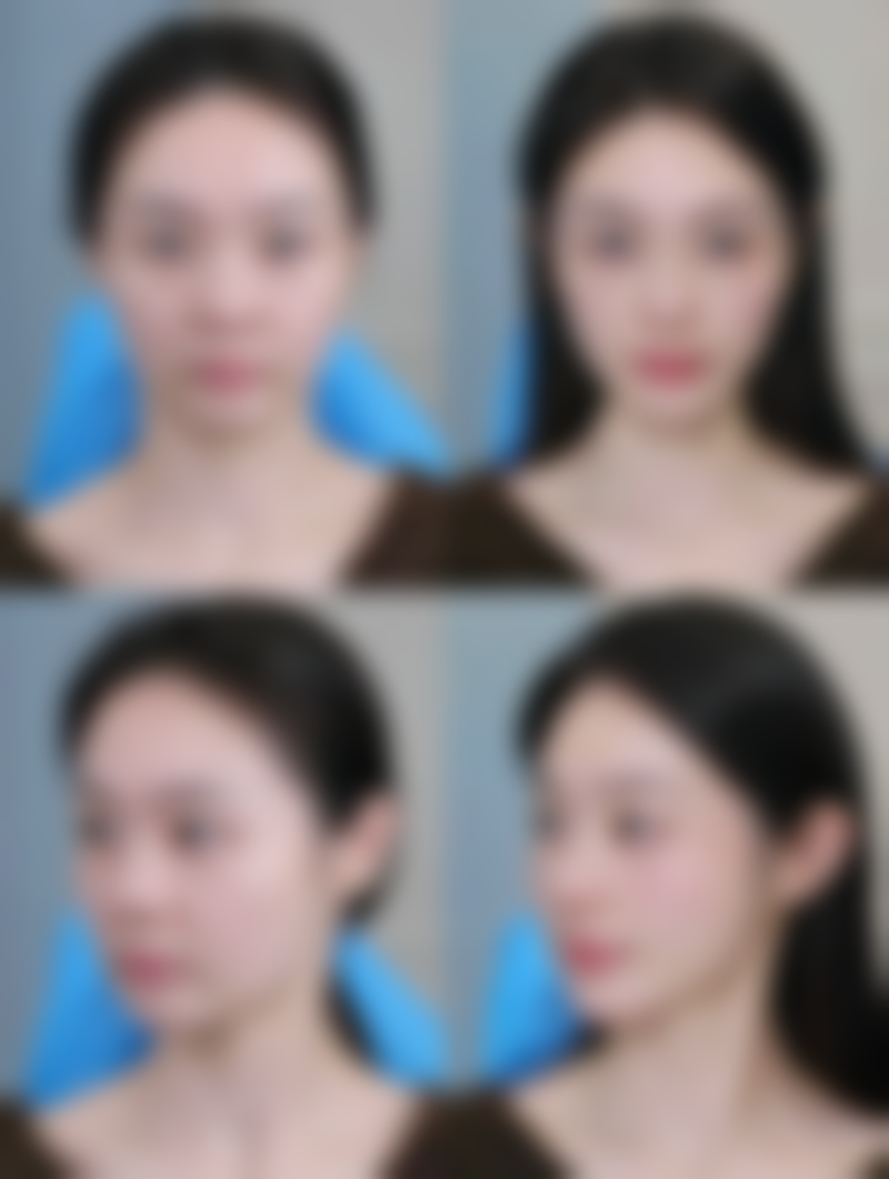 陈咸伸医生让你放心变得更美